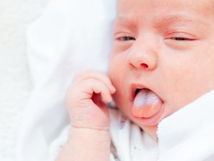 The Importance of Tongue Posture in Newborns - innobaby