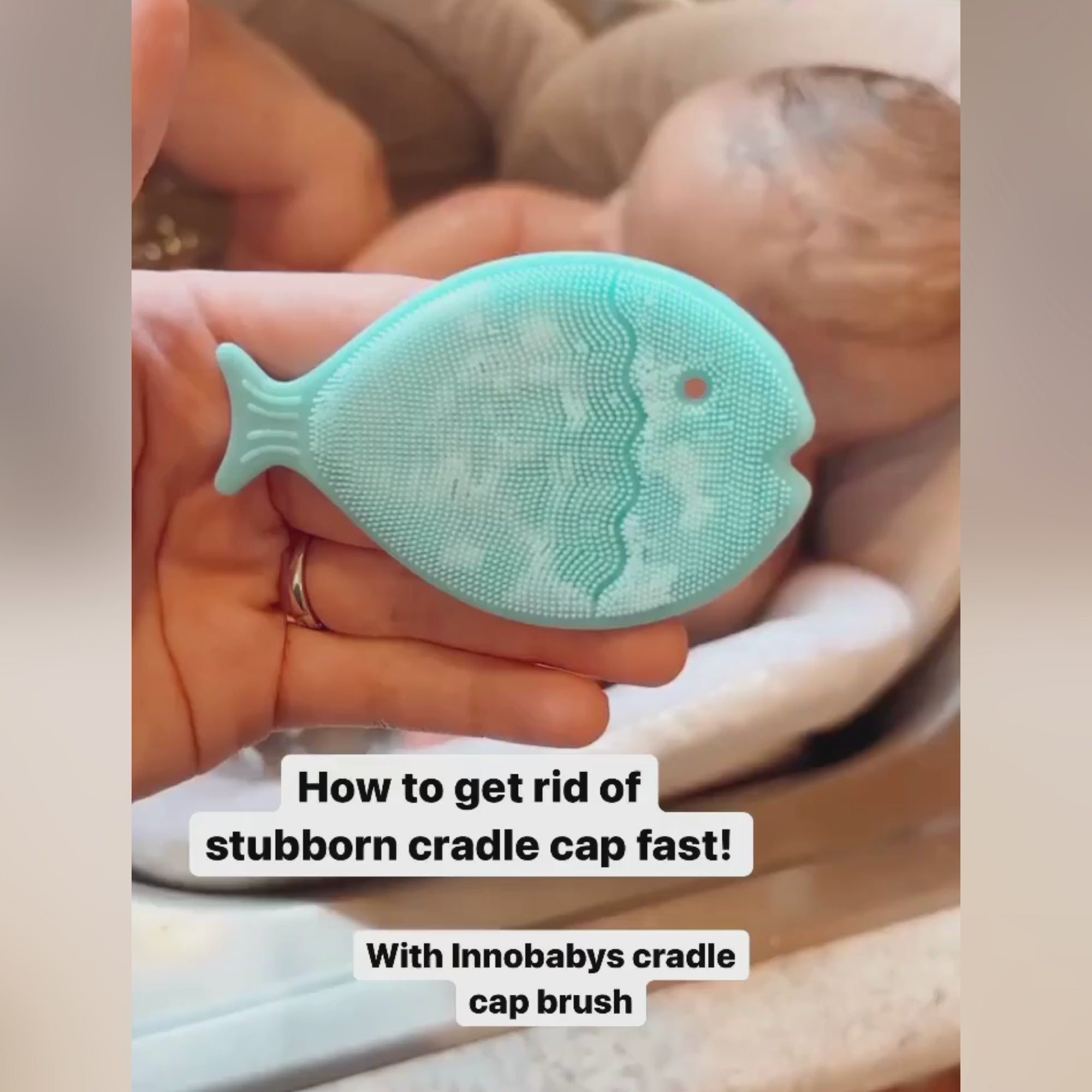 all-groups How to get rid of cradle cap